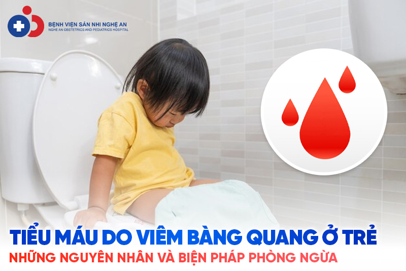Đang cập nhật