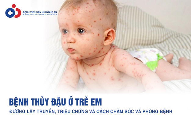 Đang cập nhật