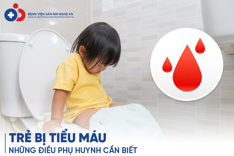 Đang cập nhật