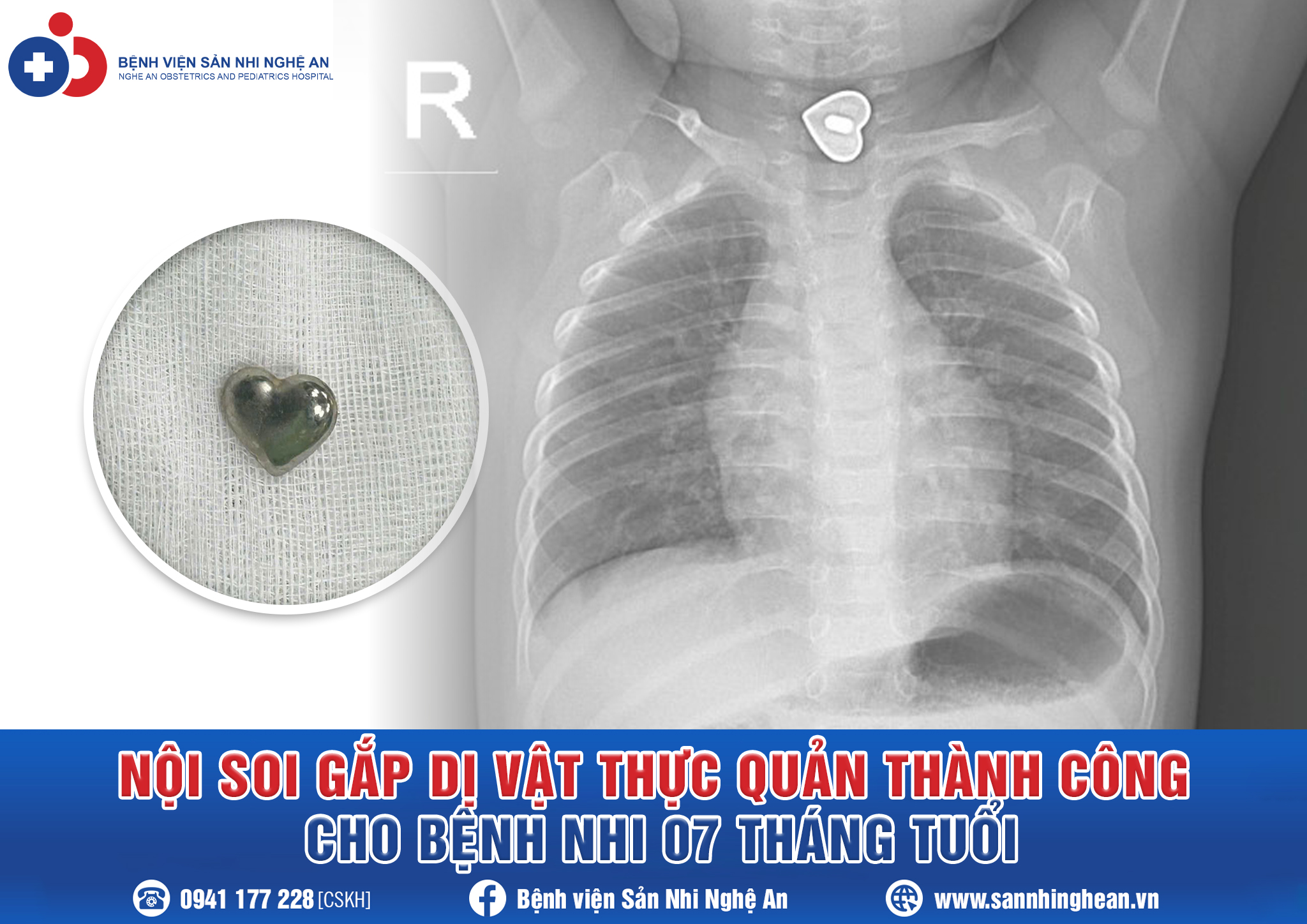 Đang cập nhật