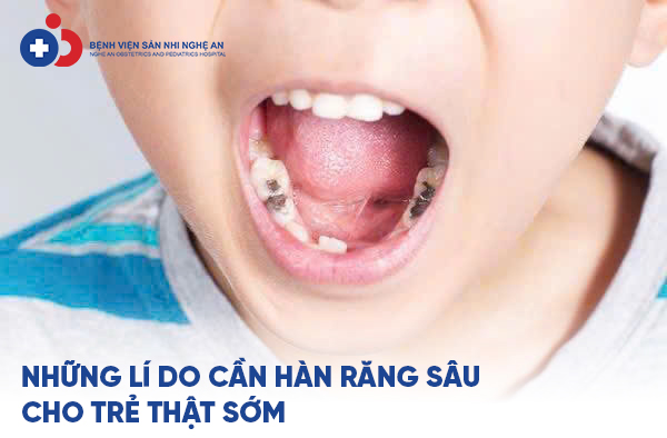 Đang cập nhật