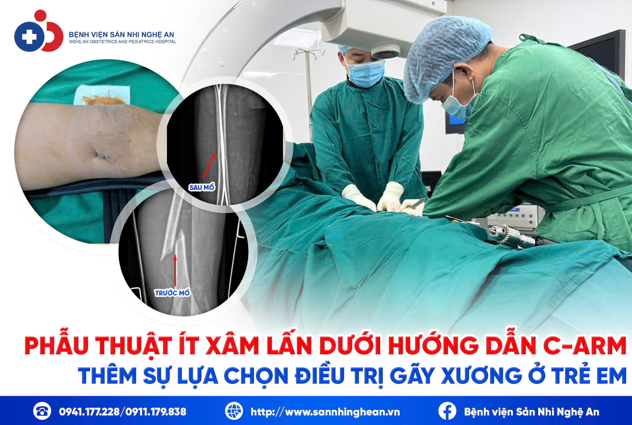 Đang cập nhật