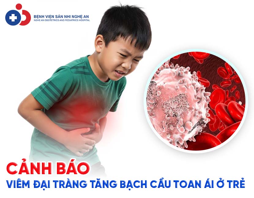 Đang cập nhật