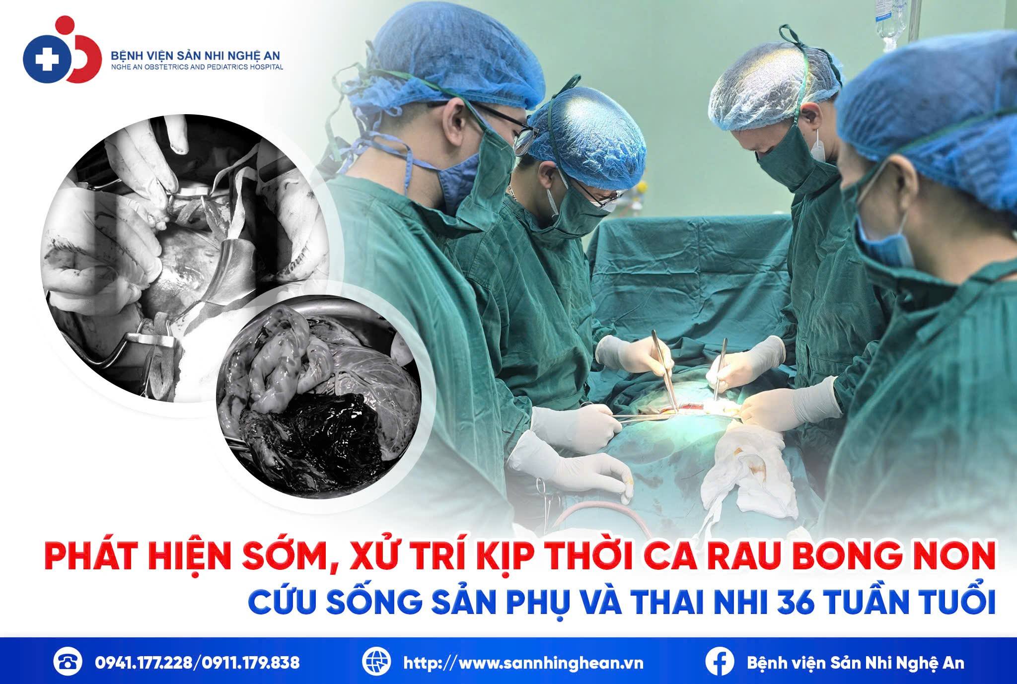 Đang cập nhật