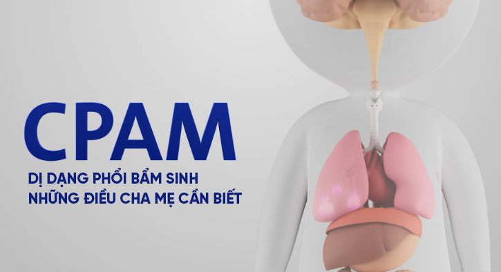 Đang cập nhật